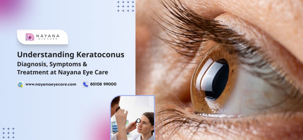 Understanding Keratoconus: Diagnosis, Symptoms & Treatment at Nayana Eye Care