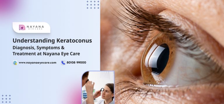 Understanding Keratoconus: Diagnosis, Symptoms & Treatment at Nayana Eye Care