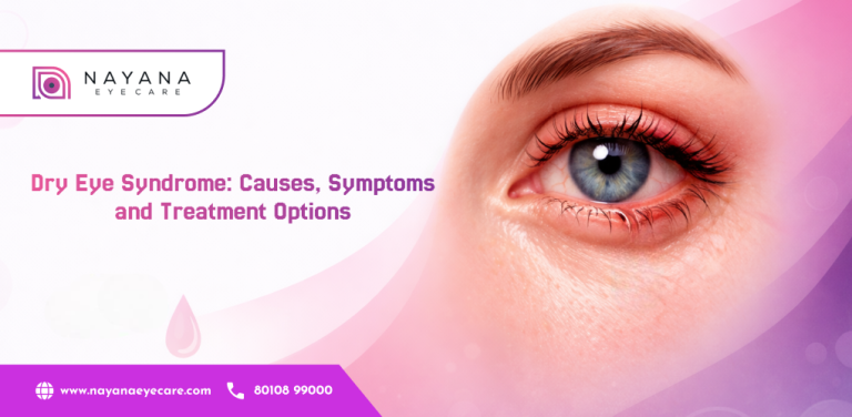 Dry Eye Syndrome: Causes, Symptoms and Treatment Options