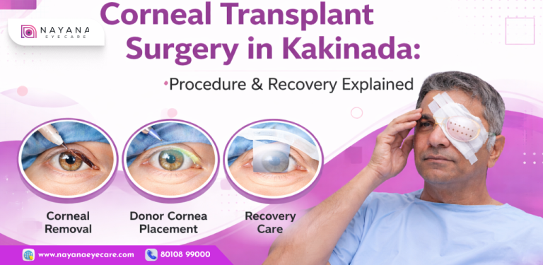 Corneal Transplant Surgery in Kakinada: Procedure & Recovery Explained