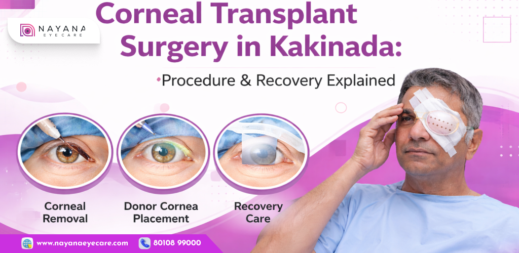 Corneal Transplant Surgery in Kakinada: Procedure & Recovery Explained