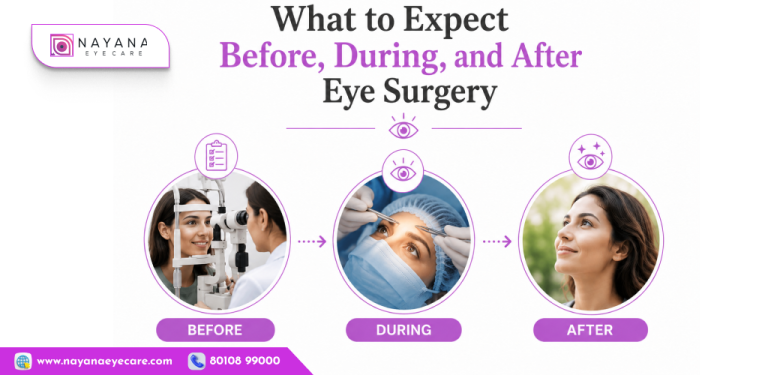 What to Expect Before, During, and After Eye Surgery